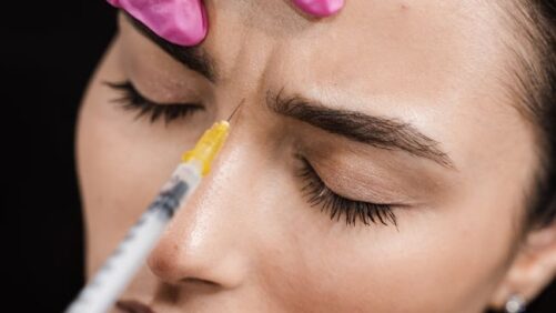 Botox oder Filler