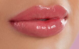 Lippenvergrößerung